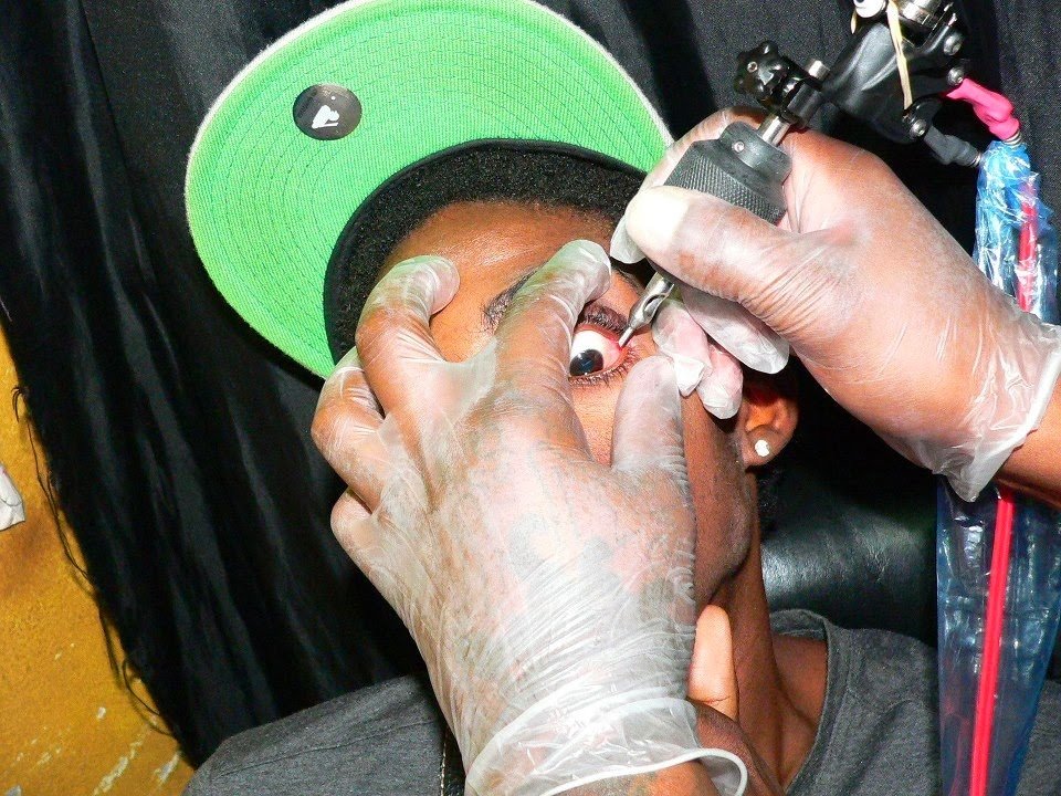 Alkaline eye tattoo procedure photo