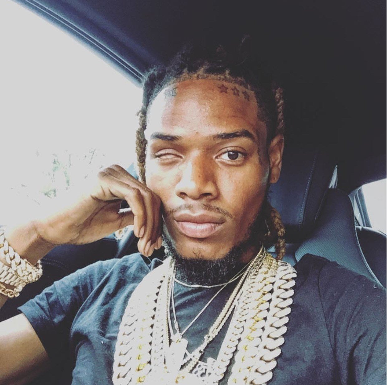 Fetty Wap Zoogang forehead tattoo