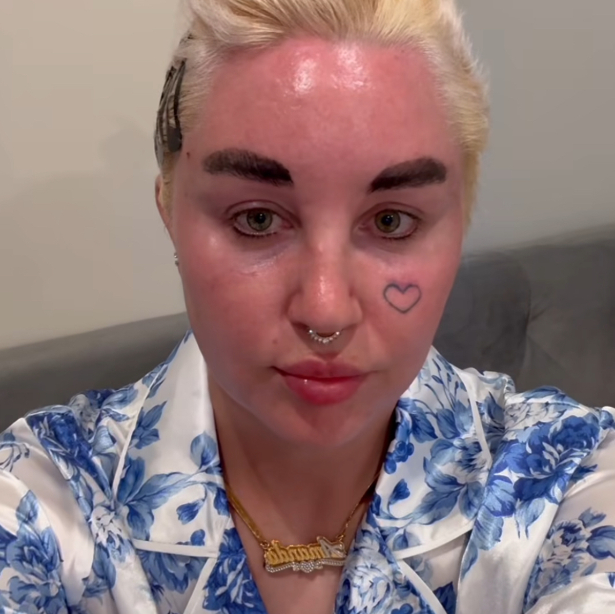 Amanda Bynes tattoos: A later view for comparing how the cheek tattoo appears in photos