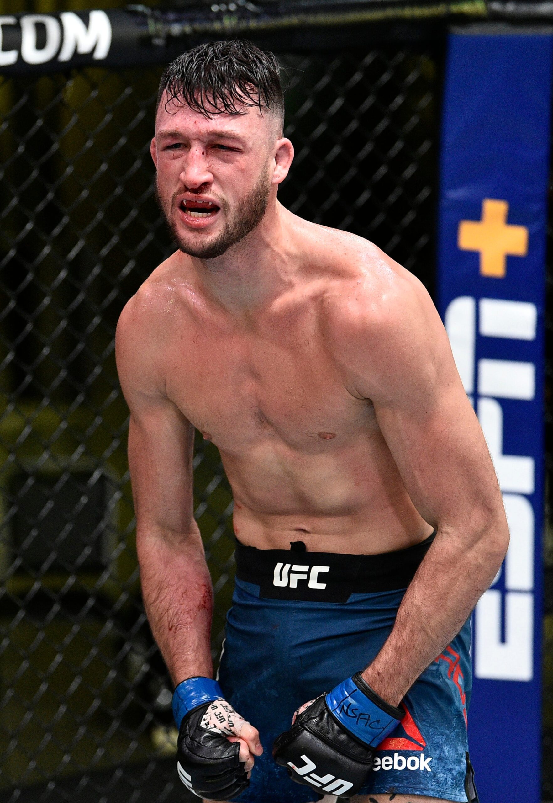 Julian Erosa in a contextual photograph: After the Woodson fight; not tattoo evidence