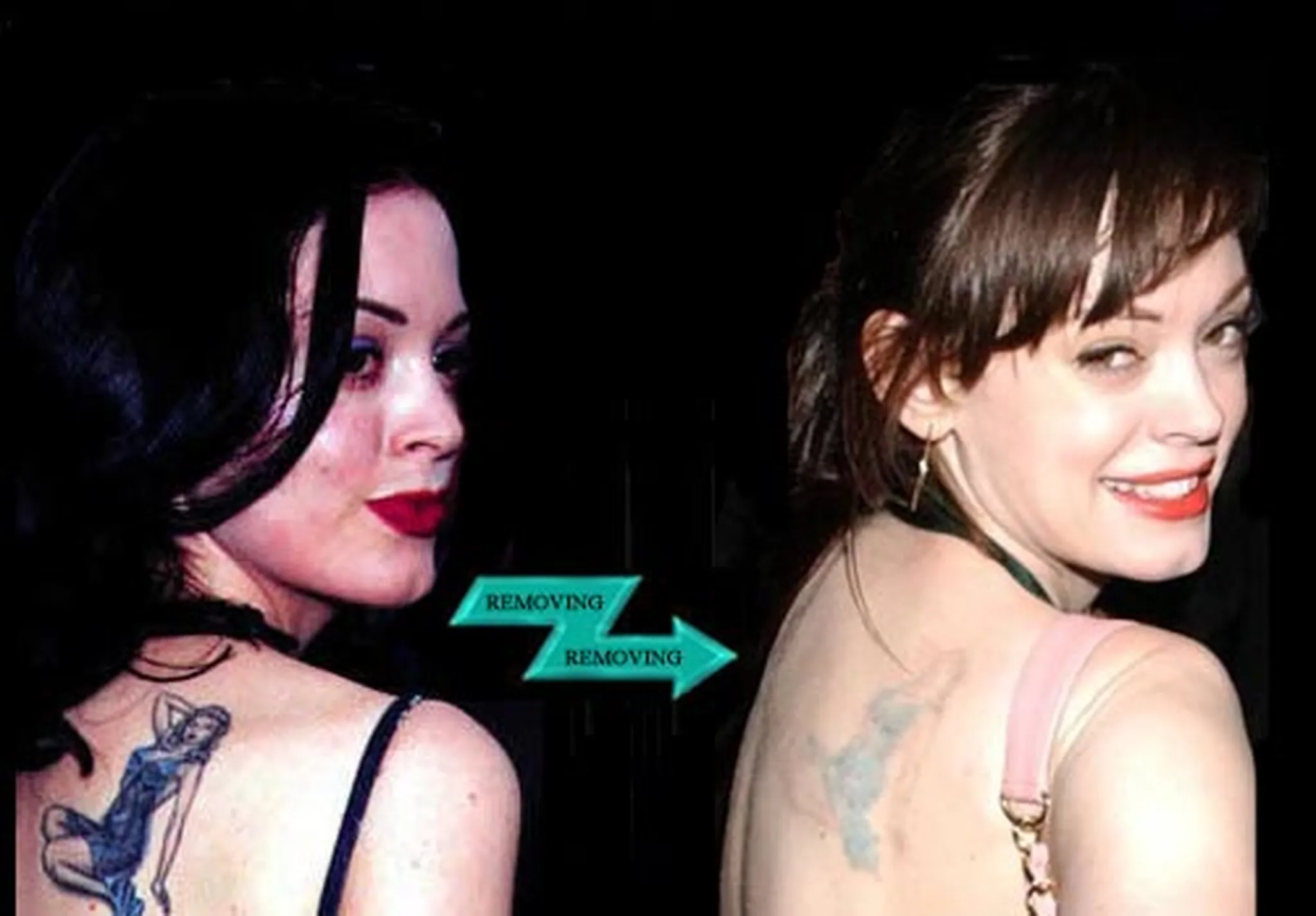 Rose McGowan tattoo removal before and after