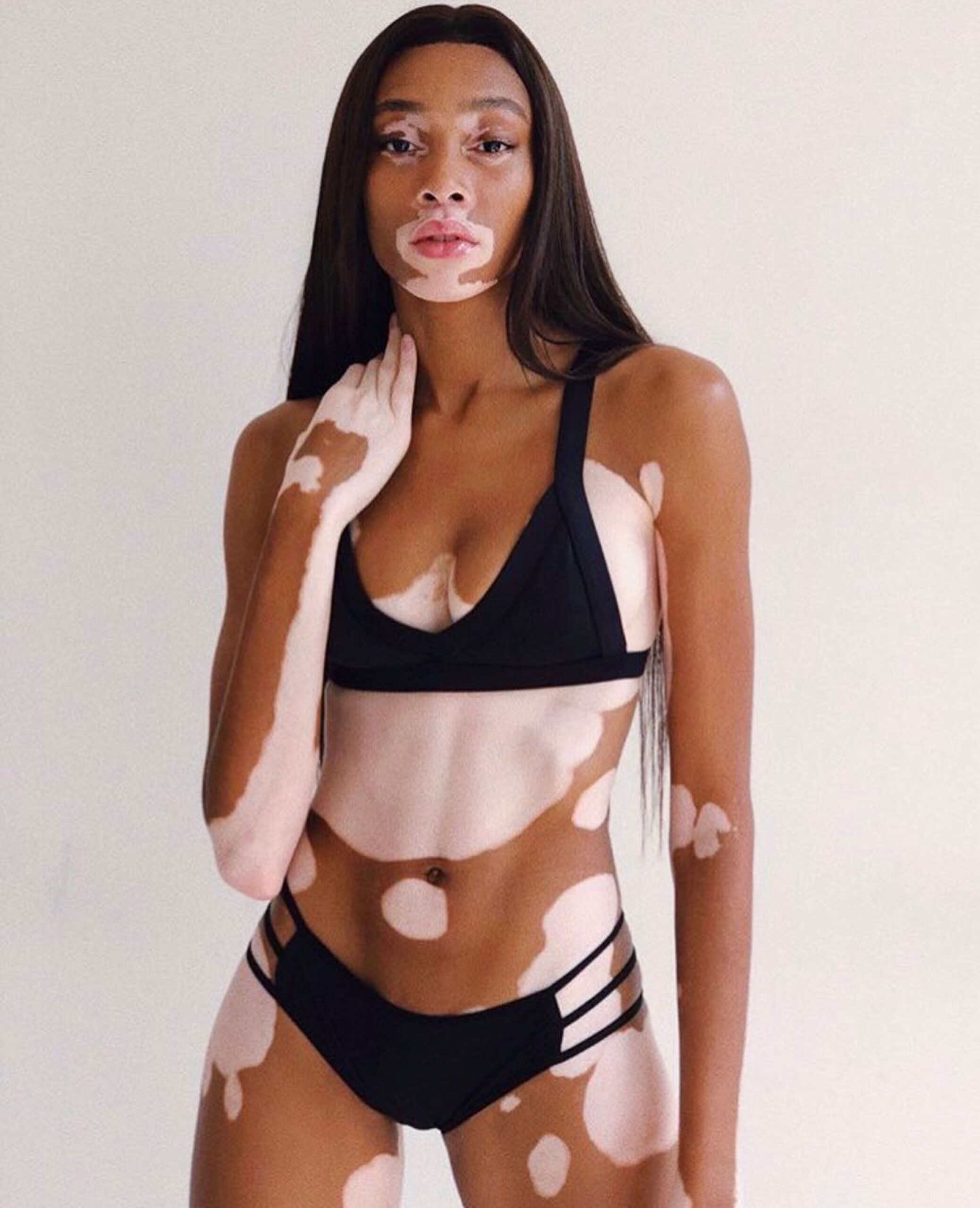 Winnie Harlow in a contextual photograph: Inline contextual photo; not tattoo evidence; not tattoo evidence
