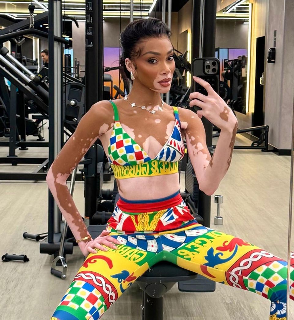 Winnie Harlow in a contextual photograph: Inline contextual photo; not tattoo evidence; not tattoo evidence