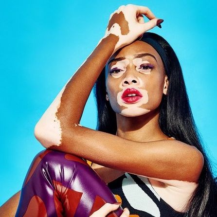 Winnie Harlow tattoos